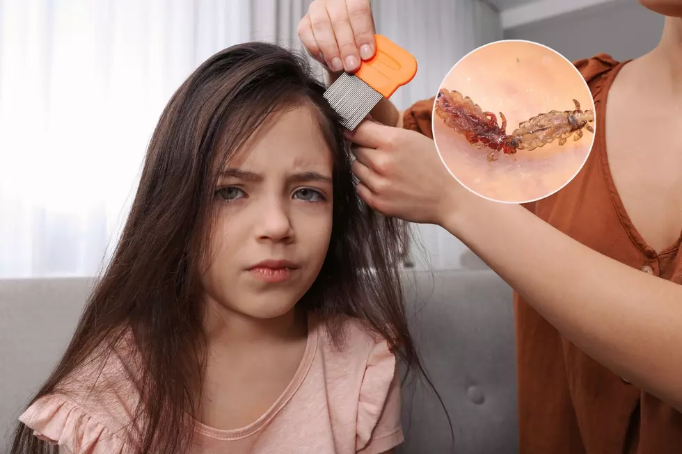Parents: What To Know About The CDC’s Updated Guidance On Lice